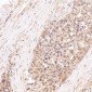 Anti-Hsp70 HSPA1A Rabbit Monoclonal Antibody
